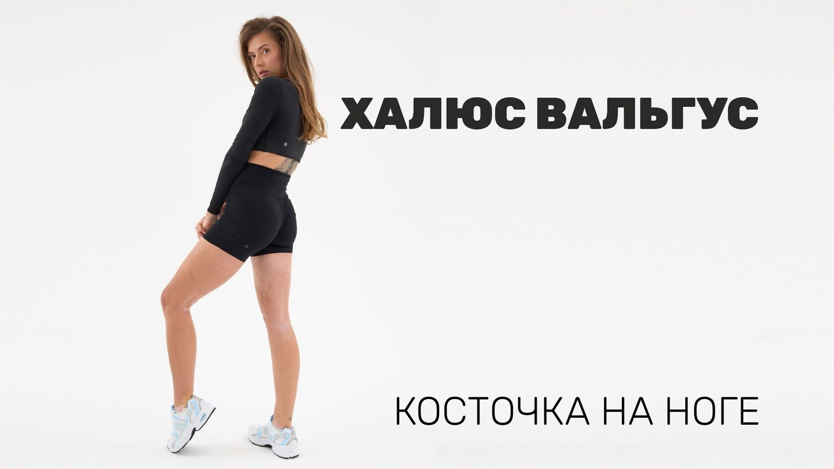 Халюс вальгус косточка на ноге